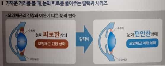 초기노안-증상-노안-나이